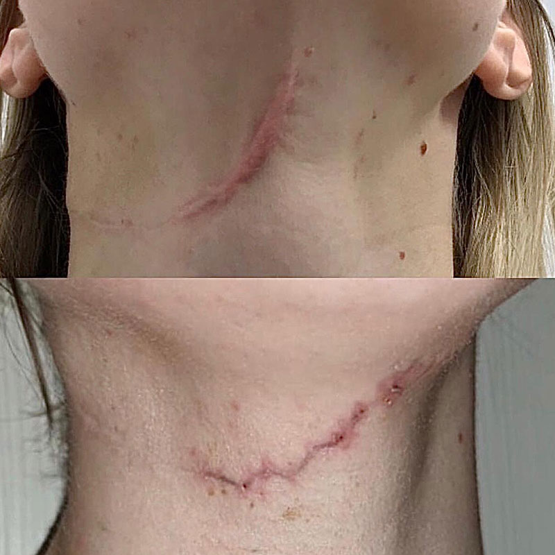 До и после операции